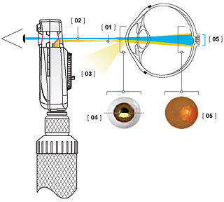 Ручной прямой офтальмоскоп с автономным питанием фирмы Heine Beta 200 с асферической оптикой - ход лучей