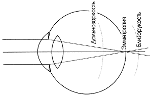 Три варианта оптической системы глаза